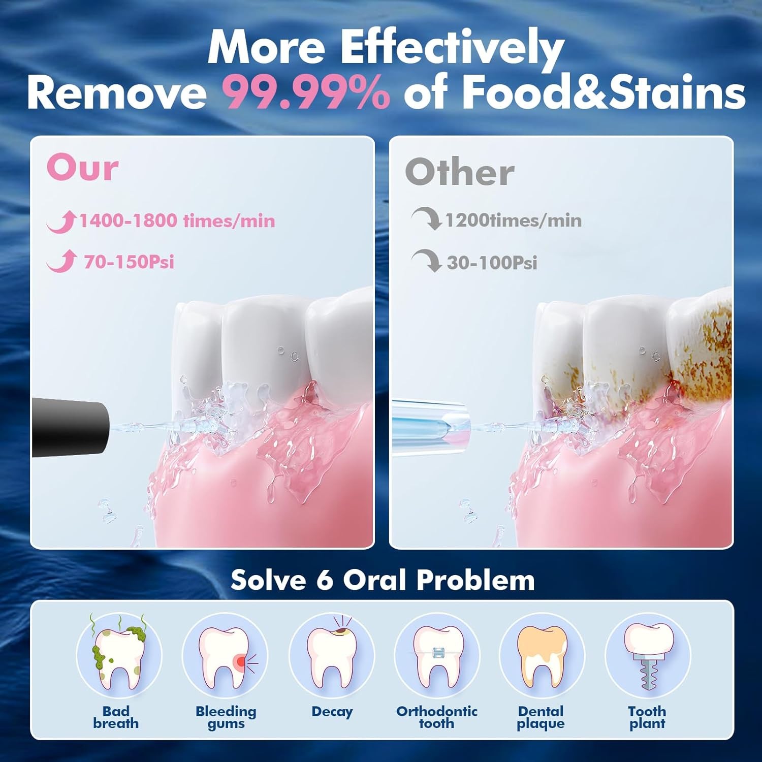 Y801 Water Dental Flosser Black