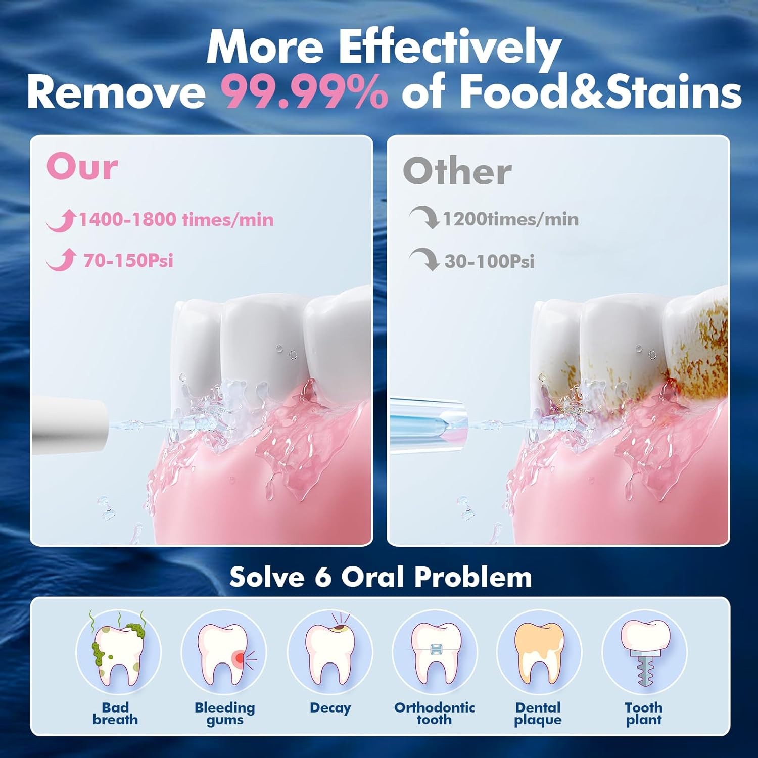 Y801 Water Flosser White