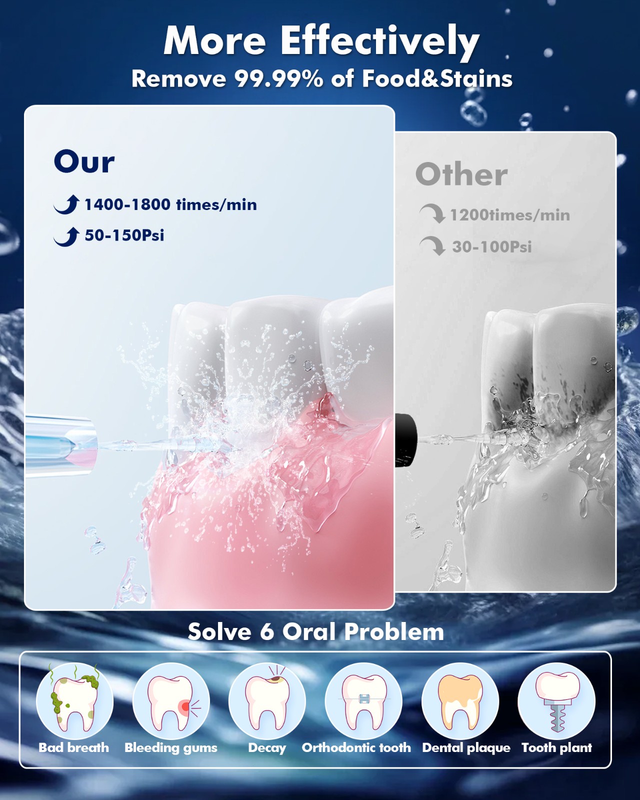 Y206 Water Flosser White